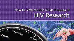 How Ex Vivo Models Drive Progress in HIV Research