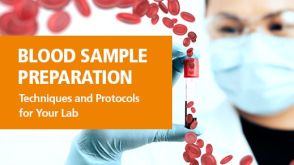 Blood Sample Preparation
