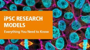 诱导多能干细胞：标准化且易获取的研究模型