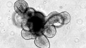 The HUB Foundation for Organoid Technology and STEMCELL Technologies Sign Agreement on the Manufacturing of Cell Culture Media for Organoids