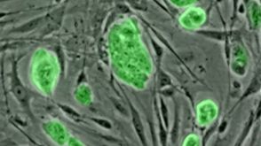 STEMCELL Technologies Inc. has just released NEW MesenCult™ Proliferation Kit with MesenPure™ (Mouse), a novel cell culture medium to advance research on mouse mesenchymal stem and progenitor cells (MSCs)