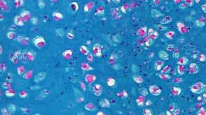 STEMCELL Technologies Introduces a New Animal Component-Free, Serum-Free Medium for Culturing Human Mesenchymal Stem Cells