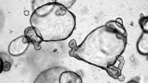 STEMCELL Technologies为全球科研界带来了突破性的肠和脑类器官培养工具