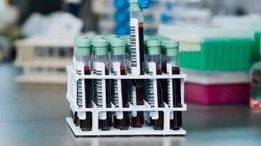 如何通过氯化铵裂解从全血制备多形核细胞？