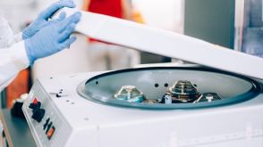 如何冻存外周血单个核细胞（PBMCs）？