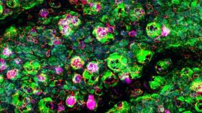 How to Perform Immunocytochemistry (ICC) Staining of Epithelial Cells Cultured as Monolayers or at the Air-Liquid Interface