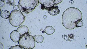 Cryopreserving Hepatic Organoids Expanded in HepatiCult™ Organoid Growth Medium (Human)