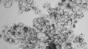 使用HepatiCult™类器官生长培养基在稀释的Matrigel®悬浮液中扩增肝类器官