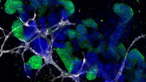 Performing Immunocytochemical Staining of PSC-Derived Kidney Organoids