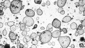 使用人肠道类器官和IntestiCult™进行药物研发毒性测试