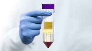 使用SepMate™在15分钟内从血液中高效分离单个核细胞