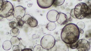 Forskolin-Induced Swelling of Airway Organoids Derived from Healthy and Cystic Fibrosis Donors