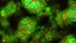 How to Generate Monolayers from hPSC-Derived Organoids Using IntestiCult™