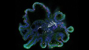 Initiating Intestinal Organoid Differentiation from Single-Cell hPSCs Using STEMdiff™