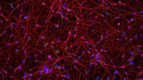 How to Culture Human Pluripotent Stem Cell (hPSC)-Derived Forebrain Neurons for MEA Analysis Using the Maestro MEA™ System