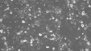 How to Prepare Conditioned Medium for the Expansion of Epithelial Cells