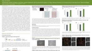 Significantly Greater Numbers of Neurons, Neurite Outgrowth and Branch Points in 21 Day Cultures of Primary Rat Cortical Neurons