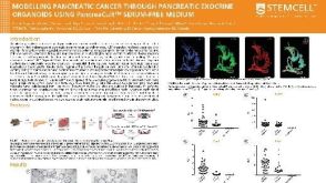 Modelling Pancreatic Cancer Through Pancreatic Exocrine Organoids Using PancreaCult™ Serum-free Medium