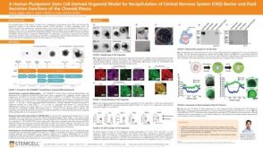 A Human Pluripotent Stem Cell-Derived Organoid Model for Recapitulation of Central Nervous System (CNS) Barrier and Fluid Secretion Functions of the Choroid Plexus