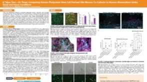 It Takes Two—Or Three: Comparing Human Pluripotent Stem Cell Derived Glia-Neuron Co-Cultures to Neuron Monoculture Under Basal and Injury Conditions