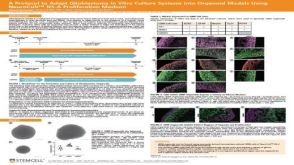 A Protocol to Adapt Glioblastoma In Vitro Culture Systems into Organoid Models Using NeuroCult™ NS-A Proliferation Medium