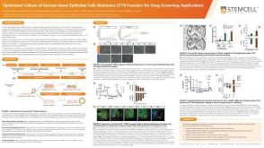Optimized Culture of Human Nasal Epithelial Cells Maintains CFTR Function for Drug Screening Applications