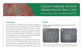 Culture Adipose-Derived Mesenchymal Stem Cells in Serum-Free, Xeno-Free MesenCult™-XF