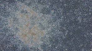 使用STEMdiff™神经诱导试剂盒通过EB法获得人多能干细胞衍生的神经祖细胞