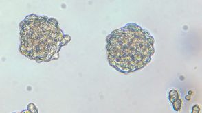 Culture Mammospheres and Tumorspheres with the MammoCult™ Medium