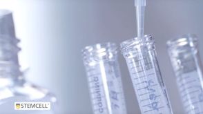 How to Culture Mouse Intestinal Organoids: Passaging