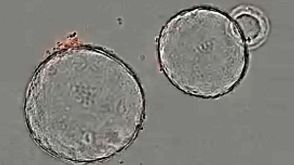 Growth of Mouse Pancreatic Organoids in PancreaCult™ Culture Medium: Under a Microscope