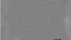 Growth of Liver Organoids in HepatiCult™ Culture Medium: Under a Microscope