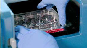 How to Standardize and Automate Hematopoietic Colony Counting in CFU Assays with STEMvision™