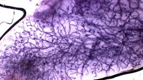 Assays for Mammary Epithelial Stem and Progenitor Cells
