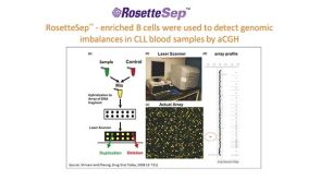 Enhance Sensitivity of Downstream Assays with Highly Purified Cells for Multiple Myeloma and CLL Research