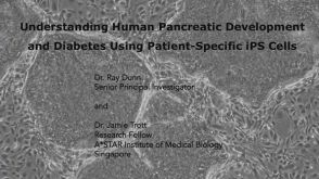 Understanding Pancreatic Development and Diabetes Using Patient-Specific iPS Cells