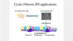 Making Lung Cells from Pluripotent Stem Cells: Disease Modeling and Future Therapies