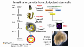 Modeling Human Gastrointestinal Development and Disease Using Pluripotent Stem Cells