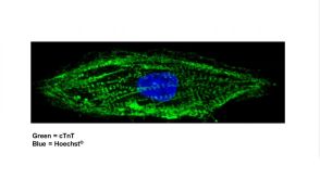 Modeling Arrhythmias Using hPSC-Derived Cardiomyocytes and Tracking Their Excitability