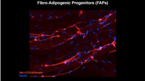 The Secret In Vivo Life of "Mesenchymal Stem Cells"