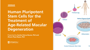 Human Pluripotent Stem Cells for the Treatment of Age-Related Macular Degeneration
