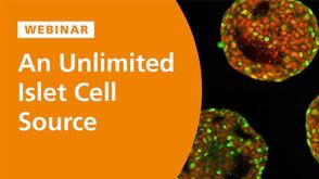 An Unlimited Islet Cell Source