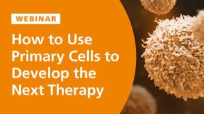 How to Use Primary Cells to Develop the Next Therapy