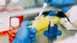 使用CRISPR-Cas9技术对人肠器官进行基因组编辑