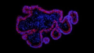 How to Establish Intestinal Organoid Culture from Isolated Mouse Intestinal Crypts