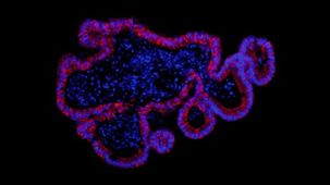 How to Generate Human Intestinal Organoid-Derived Monolayers