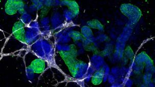 Performing Immunocytochemical Staining of PSC-Derived Kidney Organoids