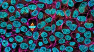 Large-Scale Expansion of hPSCs in 2D Monolayer Culture using mTeSR™ Plus