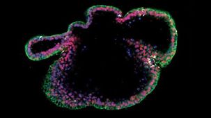 How to Prepare Single Cells from PSC-Derived Epithelial Cultures for Flow Cytometry Analysis