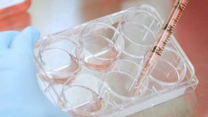 How to Generate Monocyte-Derived Dendritic Cells